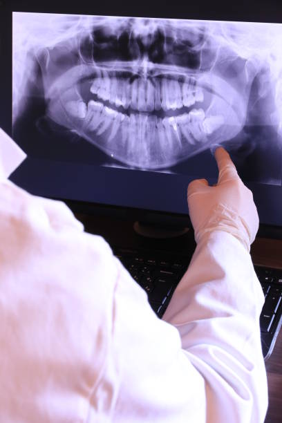 Best Emergency Dentist for Lost Fillings or Crowns in Port Morris, NJ