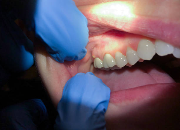 Best Orthodontic Emergency Dentist in Port Morris, NJ